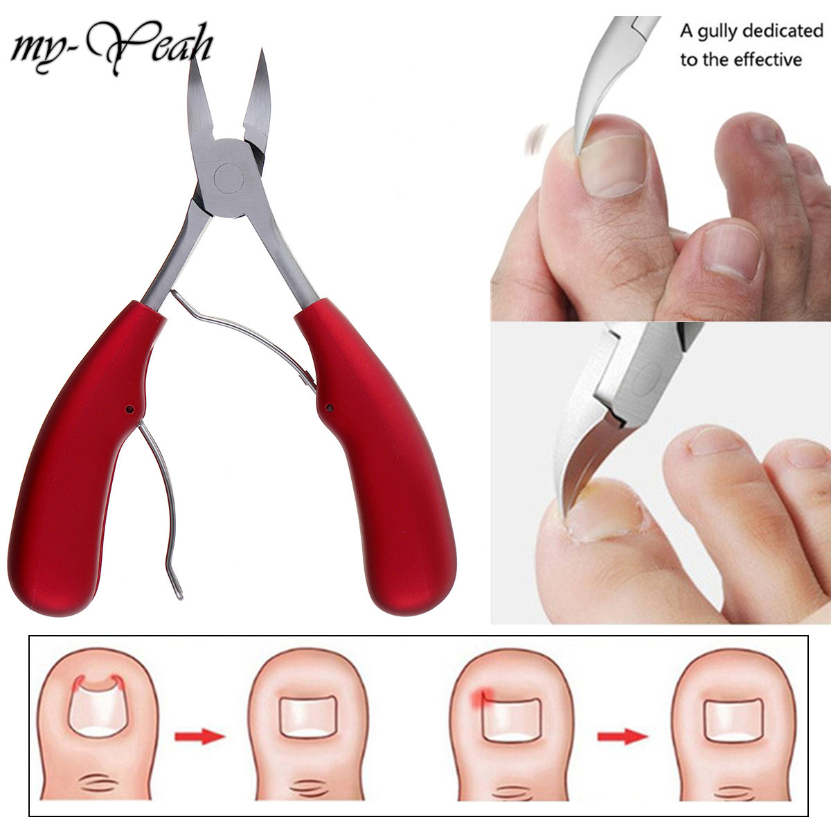 Myyeah Dụng cụ tỉa móng tay chăm sóc nghệ thuật - INTL