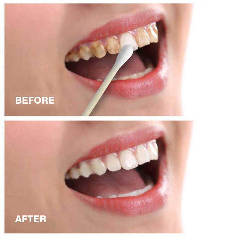 1 Bottle 10 Ml Teeth Cleaning Mouth Cleaning Liquid Teeth Bleaching Tools