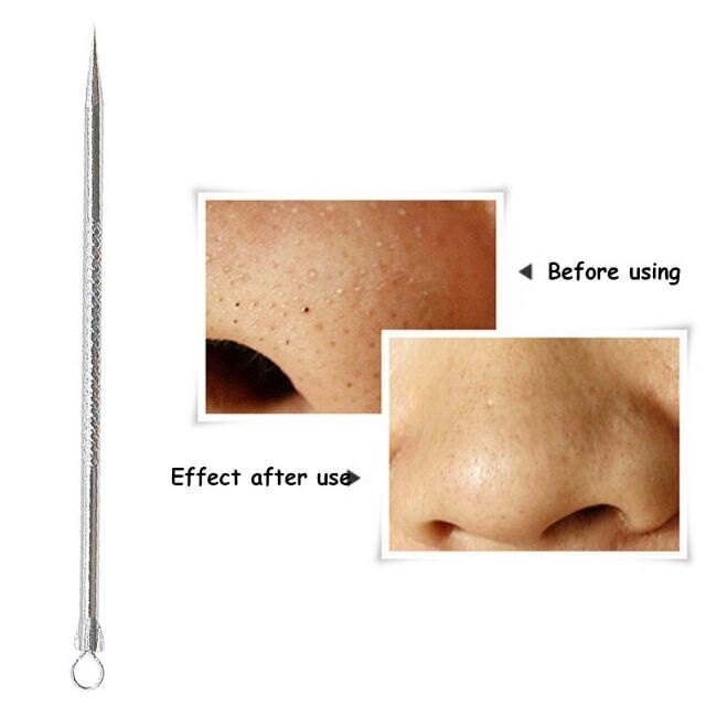 Kim Nặn Mụn Bằng Thép Không Gỉ Hai Đầu