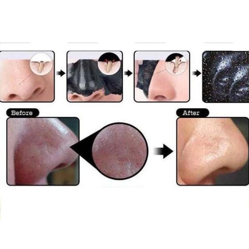 【QIAONSHOP】 Mặt Nạ Than Hoạt Tính Màu Đen Cho Mặt