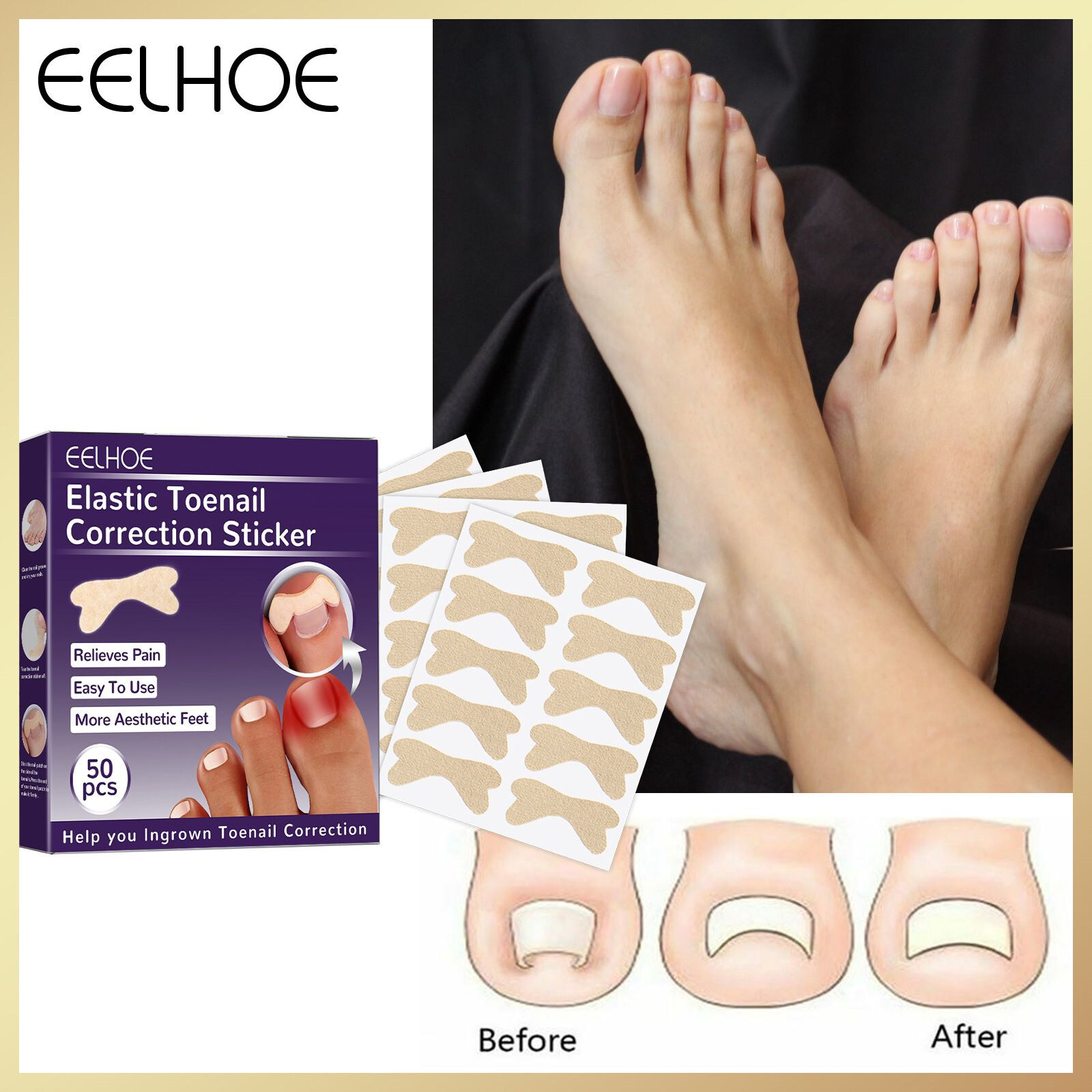 Eelhoe Elastic Toenail Correction Stickers Ingrown Toenail Corrector Patch NonGlue Paronychia