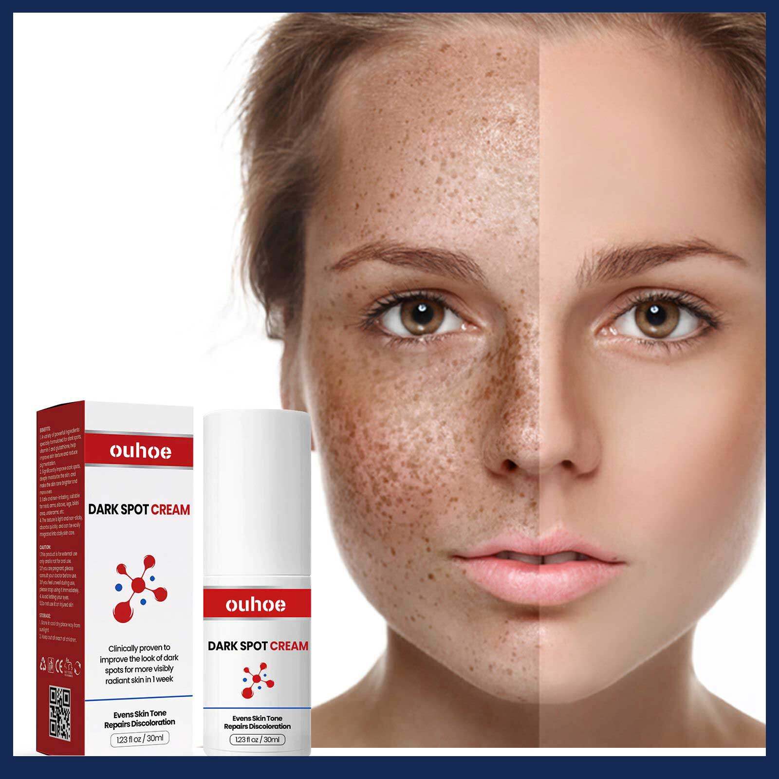 OUHOE Dark Spot Cream Whitening Cream Effective Remove Face Dark Spots Bleach Underarm Knee Buttocks Dark Skin Fast Brighten Beauty Face Skin Care Bright Skin Cream Remove Darken Modifies Uneven Colors Tones Acne Spot Dark Spot Age Spot Remover
