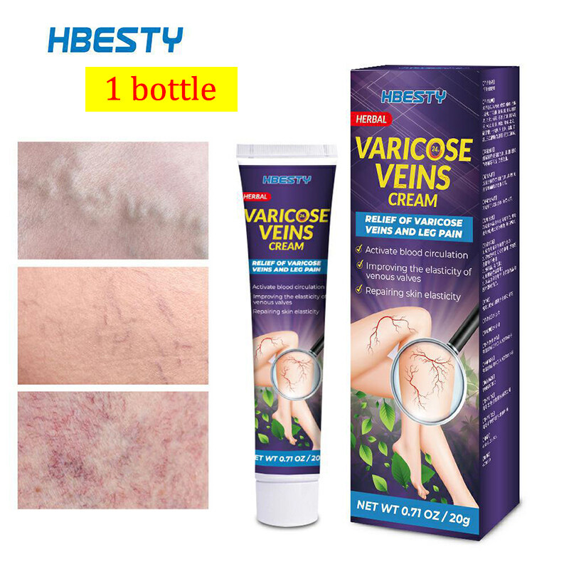 Natural Herbal Varicose Veins Treatment Cream 20g Phlebitis Pain Relief