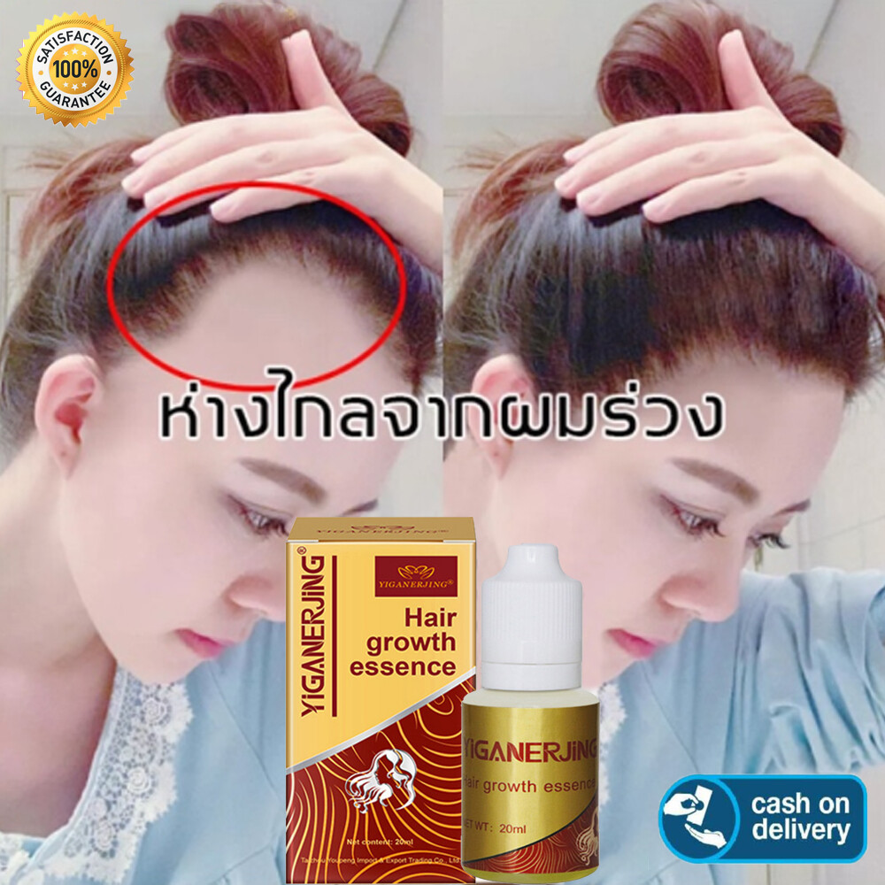 YIGANERJING Ginger Extract Dense Hair Fast Sunburst Hair Growth Essence Restoration Hair Loss Liquid Serum Hair Care Oil