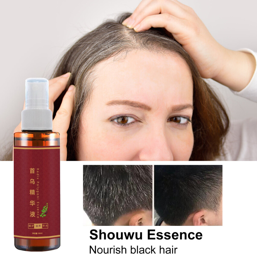 Herbal Cure White Hair Treatment Spray 100ML Herbal Shouwu Hair Liquid Change White Gray Hair To Black