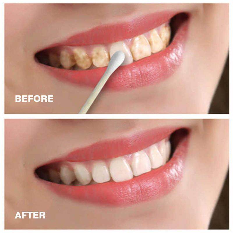 1 Bottle 10 Ml Teeth Cleaning Mouth Cleaning Liquid Teeth Bleaching Tools