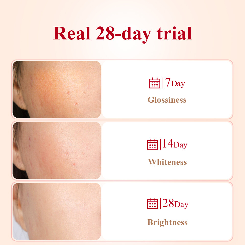 BREYLEE Mặt nạ tinh chất lựu đỏ làm trắng da