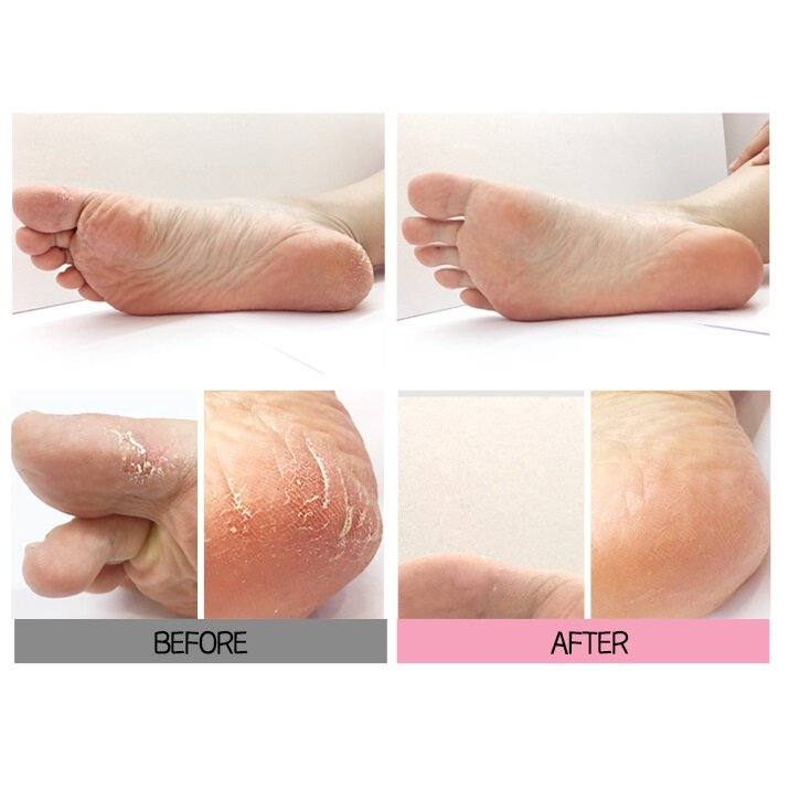 [Holika Holika] Baby Silky Foot Mask Sheet