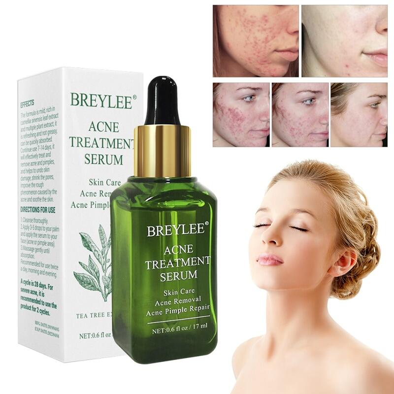 1Pc Green Tea Essence Acne Treatment Serum Facial Anti Acne Scar Removal Skin Care Whitening Pimple Remover Repair Liquid Facial