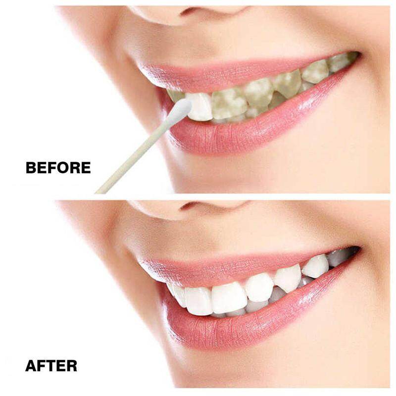 1 Bottle 10 Ml Teeth Cleaning Mouth Cleaning Liquid Teeth Bleaching Tools