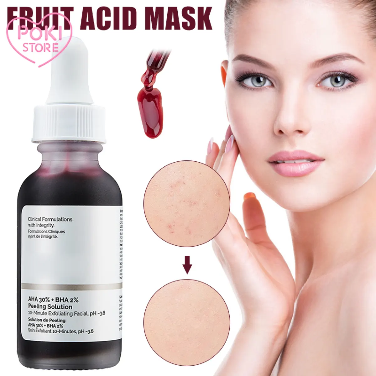 the ordinary aha bha acne scars