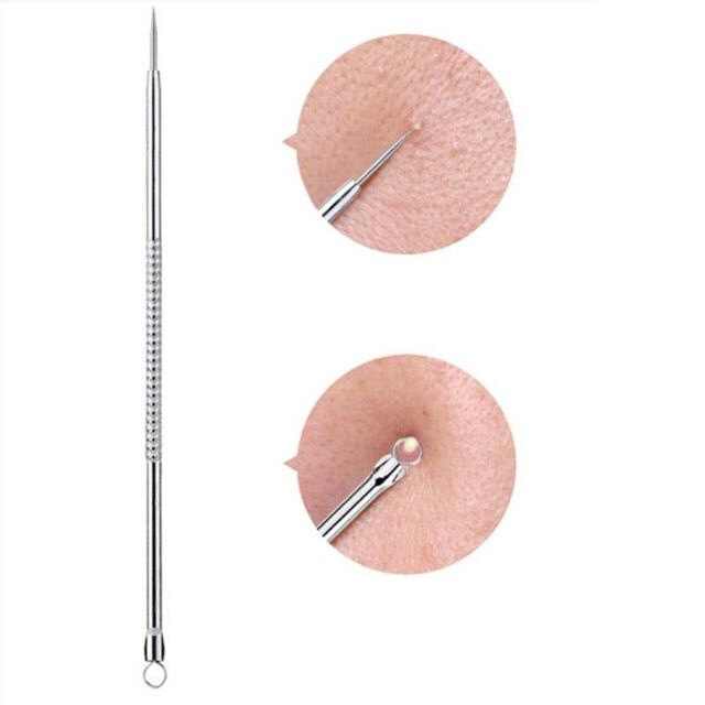 Kim Nặn Mụn Bằng Thép Không Gỉ Hai Đầu