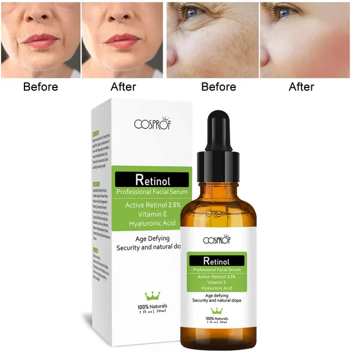 cosprof retinol
