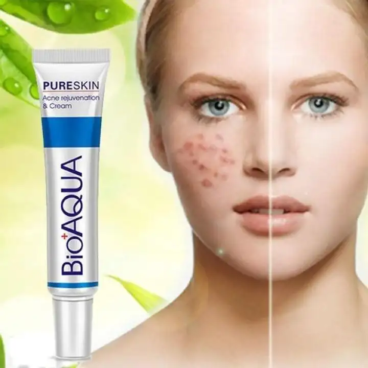acne rejuvenation cream