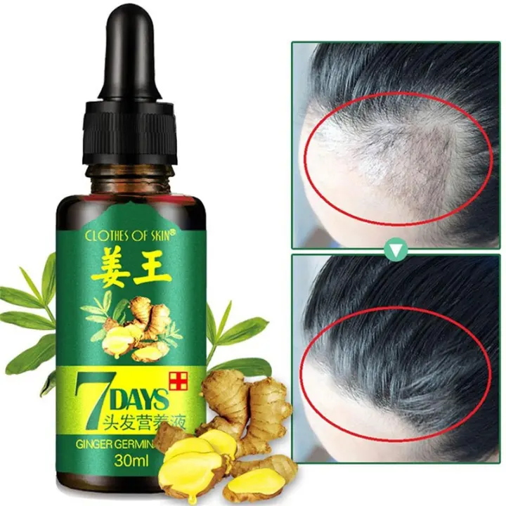 7 Days Hair Growth Serum Essence For Men And Women Anti Preventing