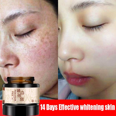 Powerful Whitening Freckle Cream Herbal Plant Face Cream Remove Freckles Dark Spots Skin Care 30g