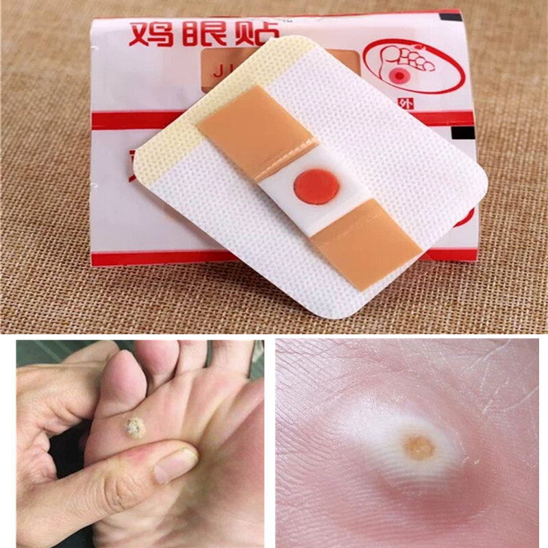 6pcs Medical plaster Foot Corn Removal Remover Warts Thorn Plaster Of Calluses Patch Callosity Detox Foot Pad Curative Plasters