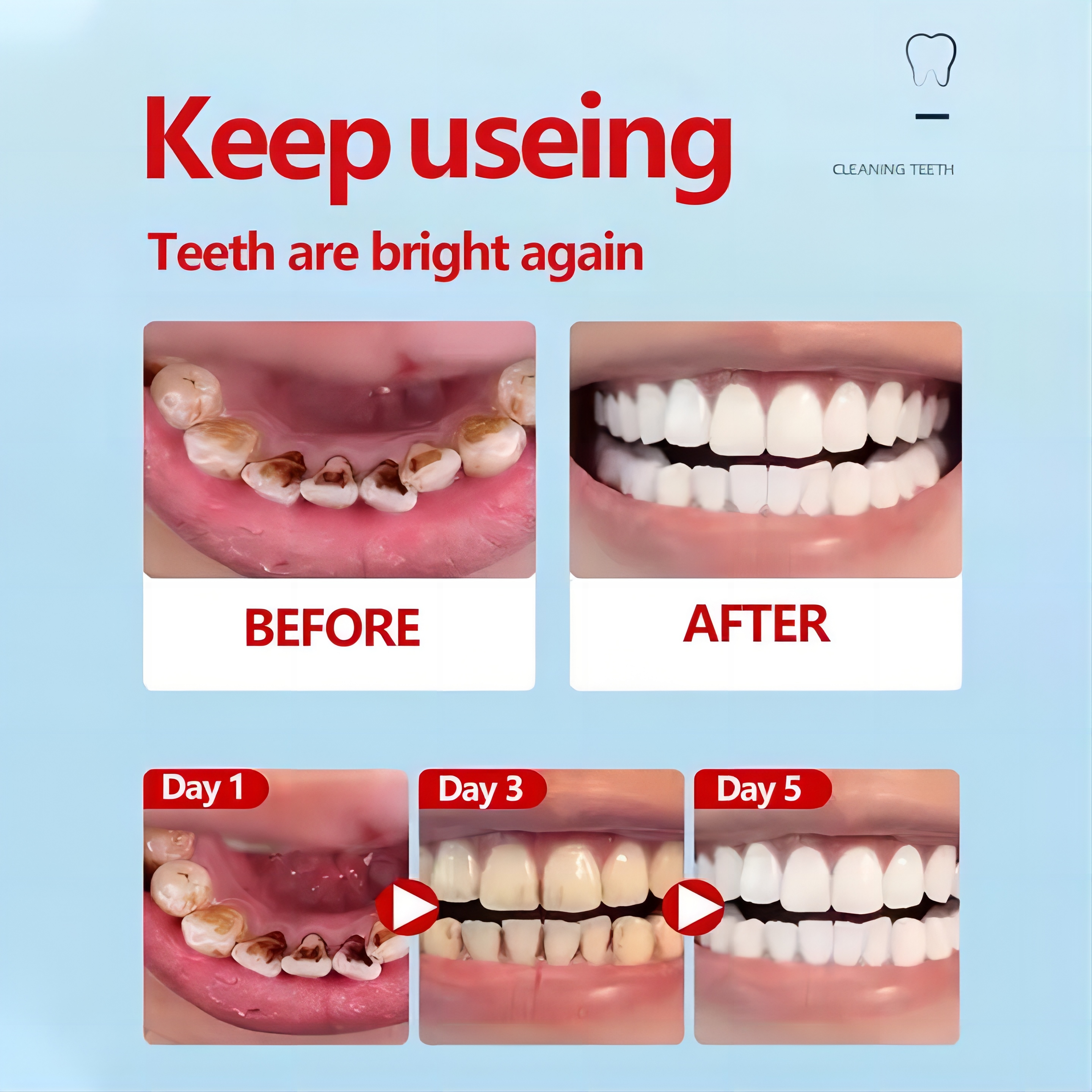 Kem đánh răng hunmui Dentist's Choice Probiotic (100g, xanh phiên bản màu trắng)