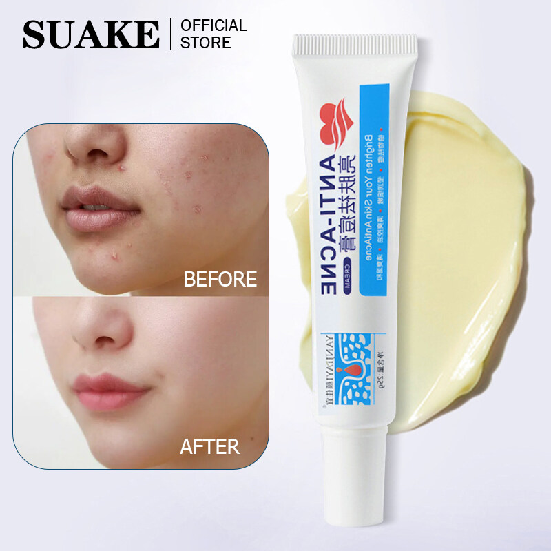 SUAKE Loại Bỏ Mụn Nhọt Nhanh Chóng Kem Trị Mụn Làm Mờ Vết Mụn Sửa Chữa Vết