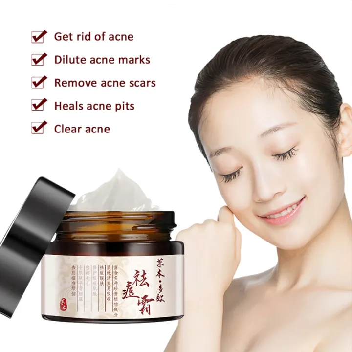 remove acne cream