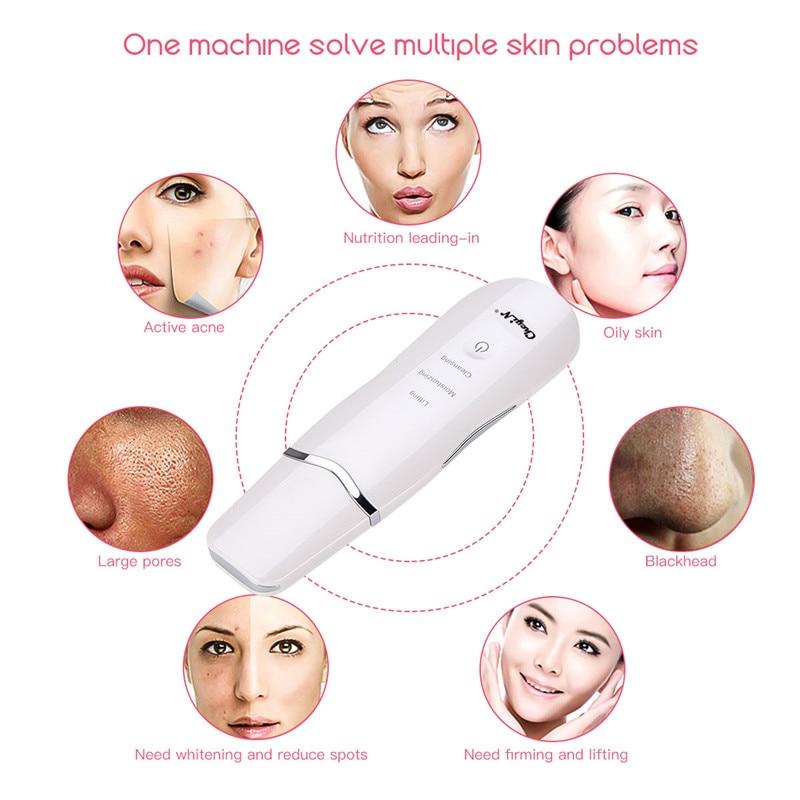 Professional Ultrasonic Facial Skin Scrubber Ion Deep Face Cleaning ...