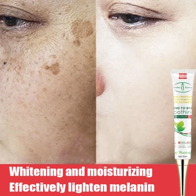 Aichun Beauty Effective Whitening Freckle Cream Remove Melasma Acne Dark Spot Melanin Pigmentation Moisturizing Gel Skin Care 30ml