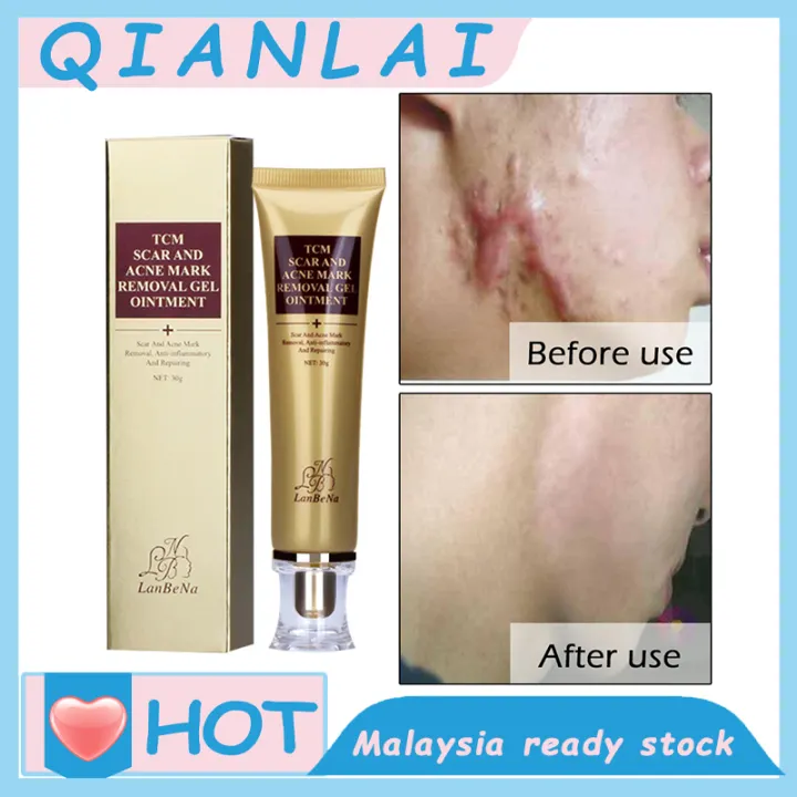 pigmentation marks removal cream