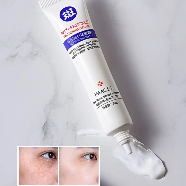 anti freckle whitening cream