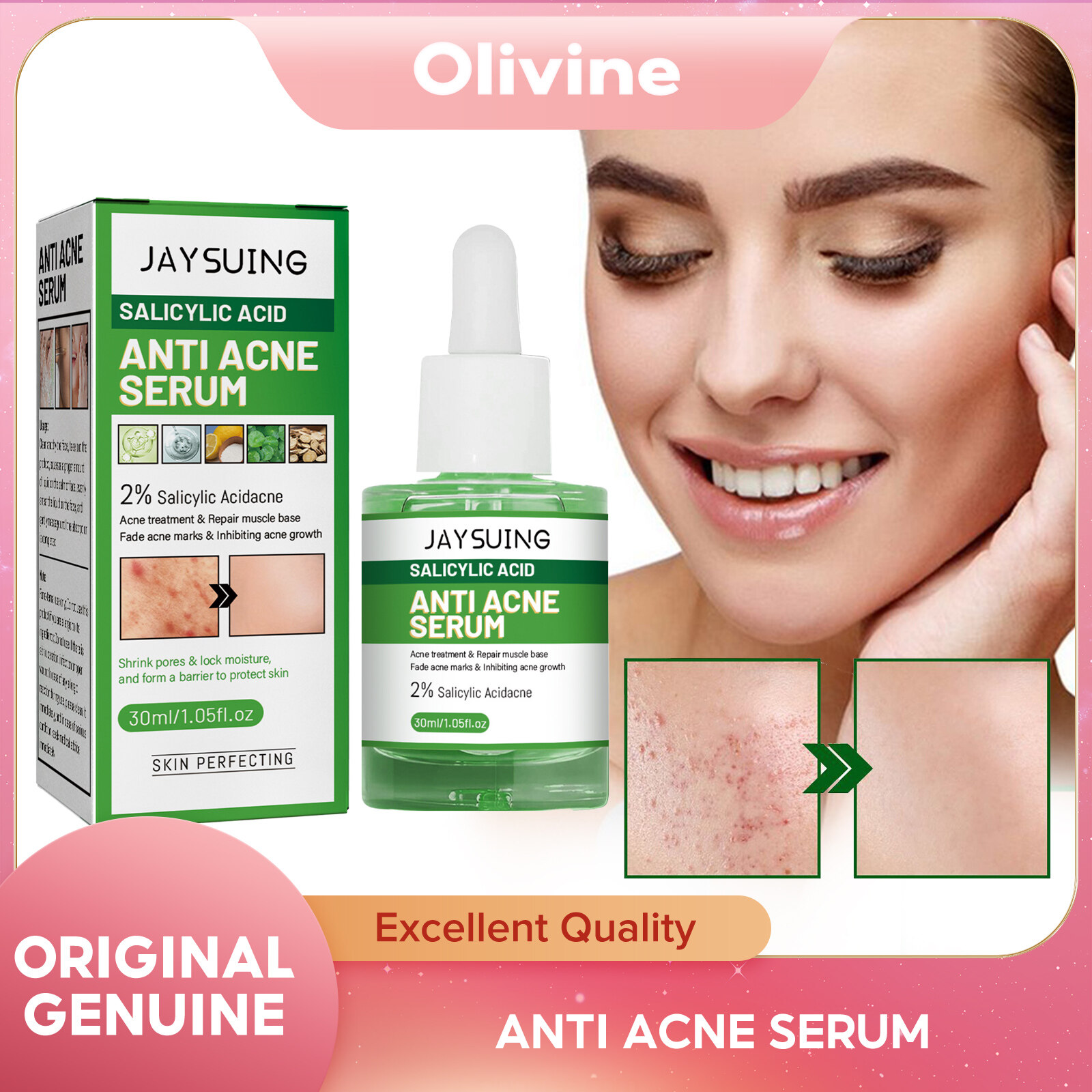 Jaysuing Acne Treatment Serum Salicylic Acid Repair Fade Acne Spots