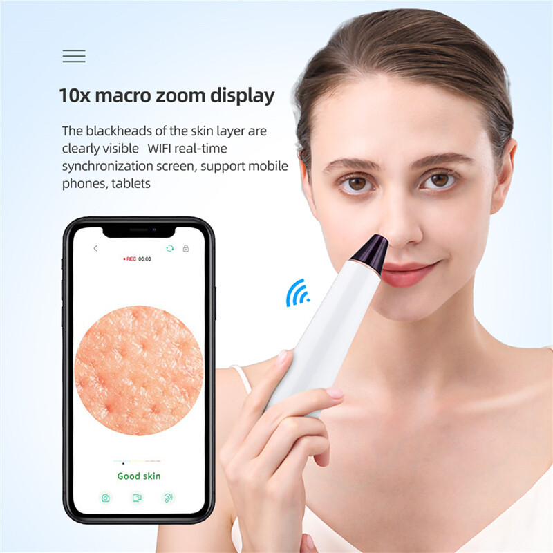 CkeyiN Heating Blackhead Removal Tool WiFi Visualized Hot Compress Blackhead Acne Pore Cleaner