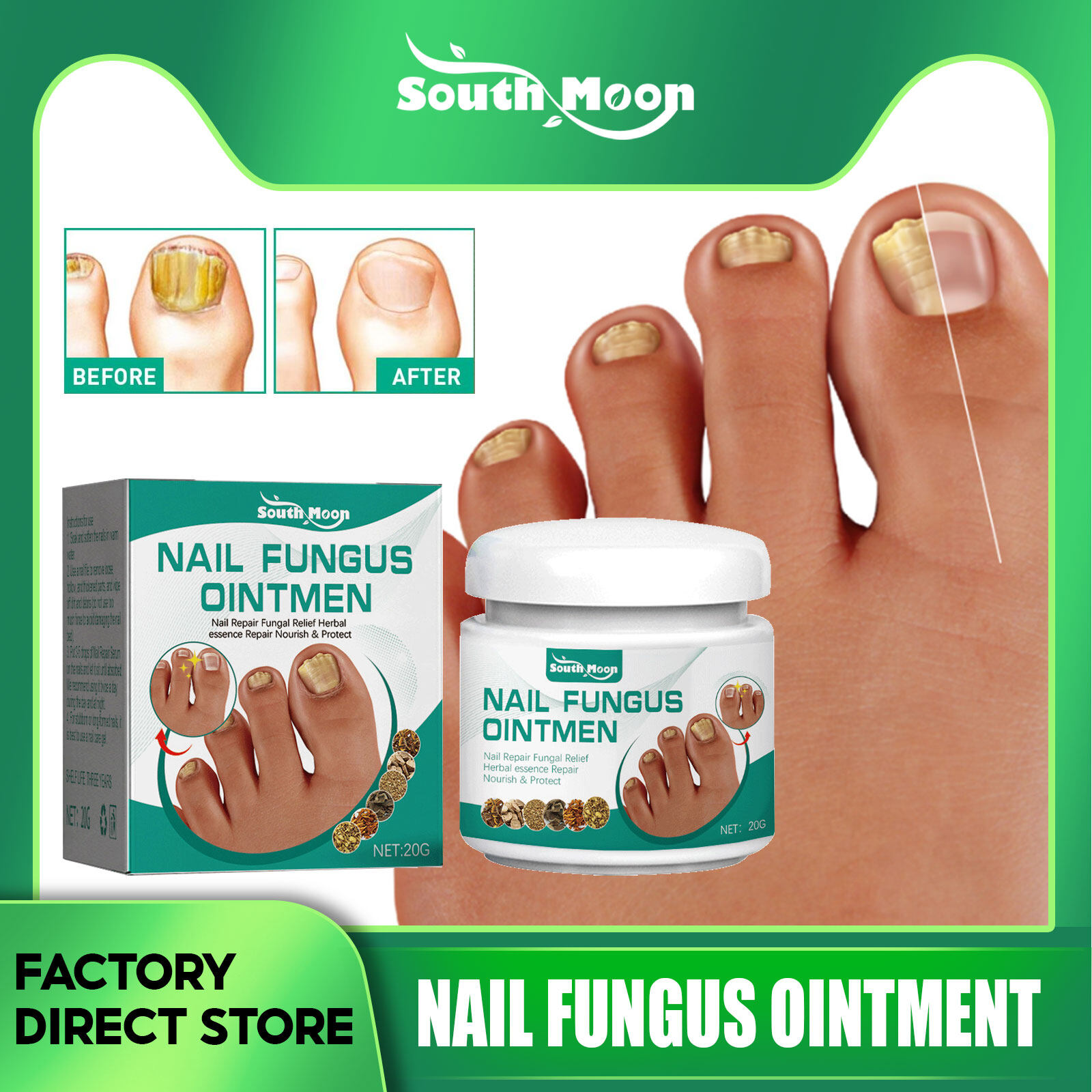 South Moon Nail Fungus Ointment Nail Fungus Treatment Essence Serum
