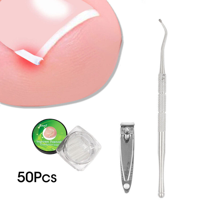 Toenail Correction set Pad Glue Extractor Nipper Ingrown Toe Nail