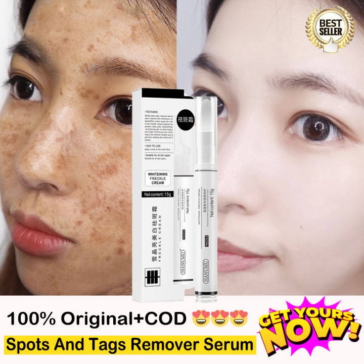 whitening freckle corrector