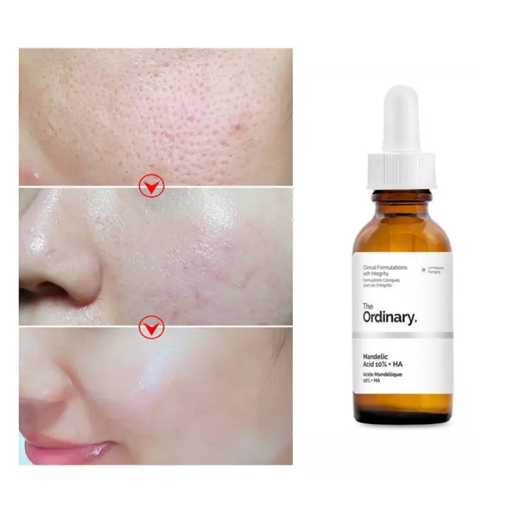 the ordinary serum for pores