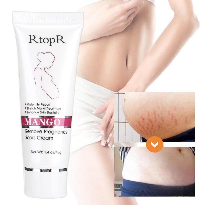 Trị Rạn Da Sau Sinh Sửa Chữa Kem Nếp Nhăn Cách Pha Loãng Tẩy