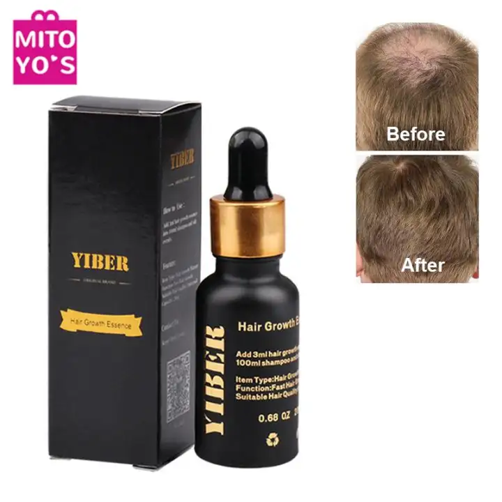 Yiber Hair Growth Essence For Hair Loss Problem Treatment Tonic