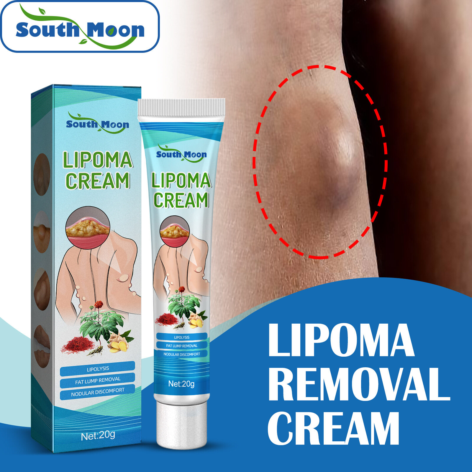 what-is-a-skin-lump-symptoms-causes-diagnosis-treatment-and-prevention