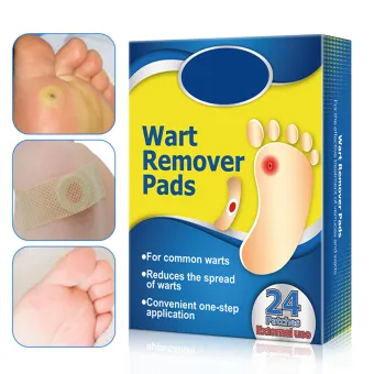cost to remove corns on feet