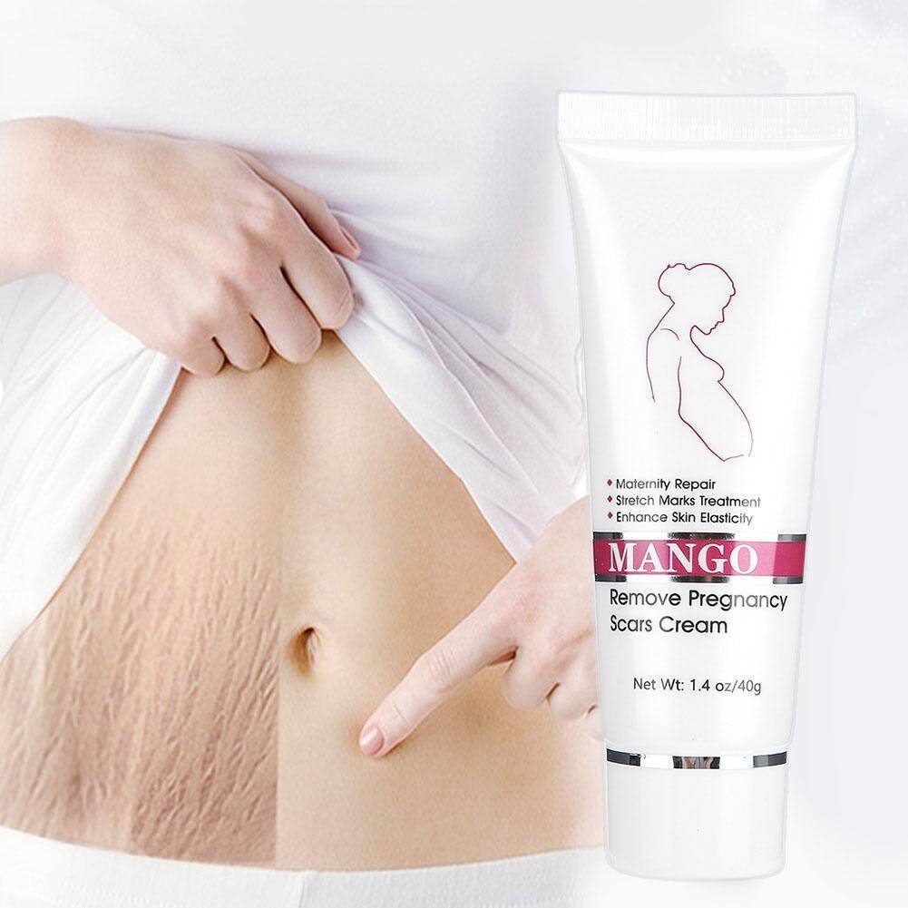 [100% Original] Stretch Marks After Childbirth Wrinkle Recovery Cream Thinning Removal Cream