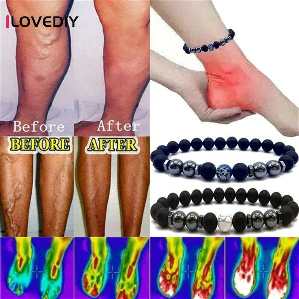 ILOVEDIY Anti Swelling Magnetic Therapy Obsidian Anklet Unisex Charm ilovediy-anti-swelling-magnetic-therapy-obsidian-anklet-unisex-charm