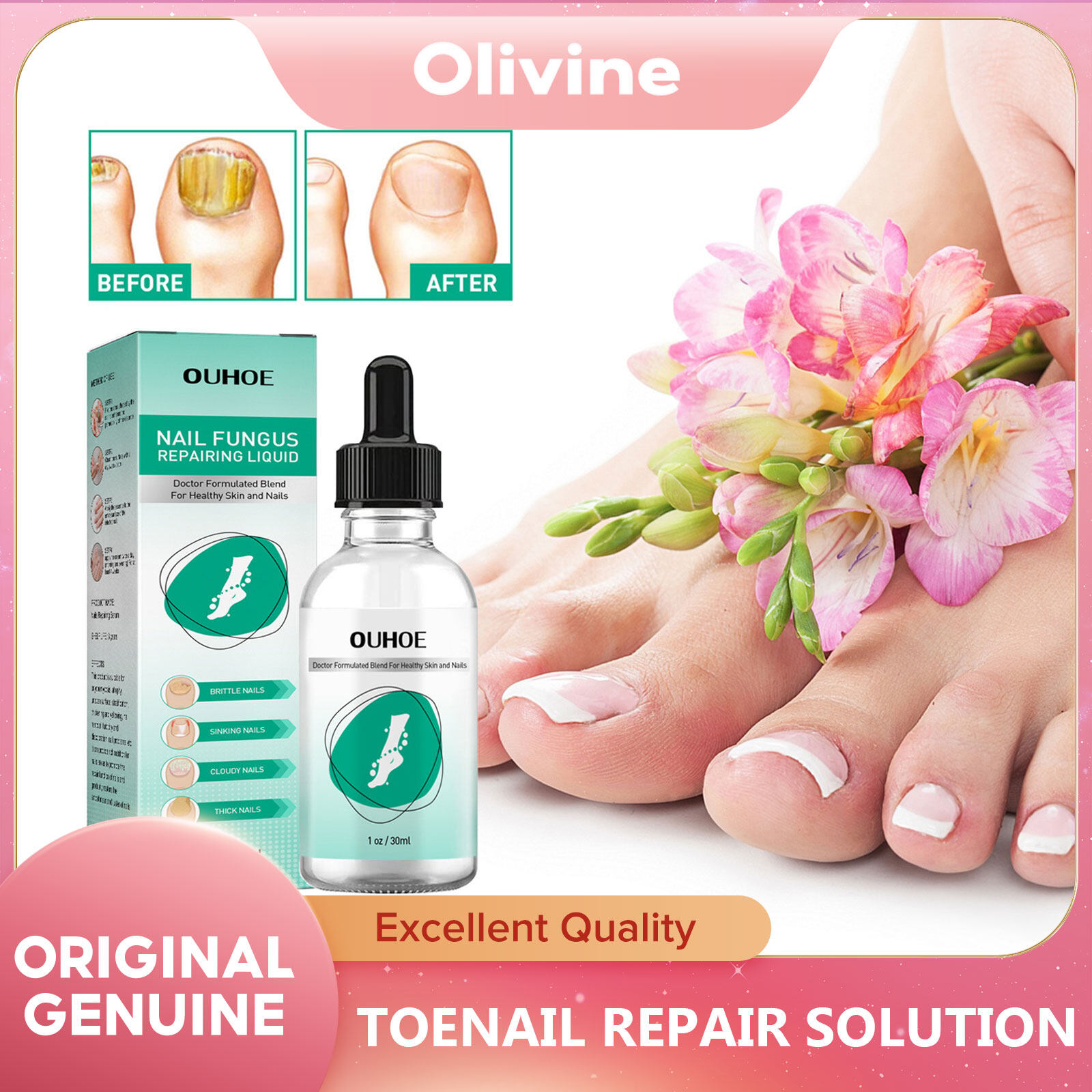 Ouhoe Toenail Repair Solution Nail fungus cure nail repair nail fungus ...