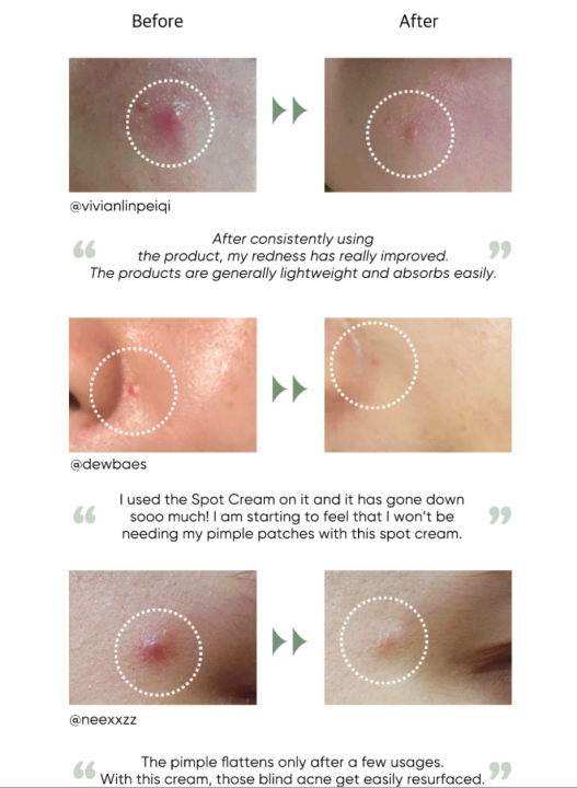 vitamin e microneedle spot cream