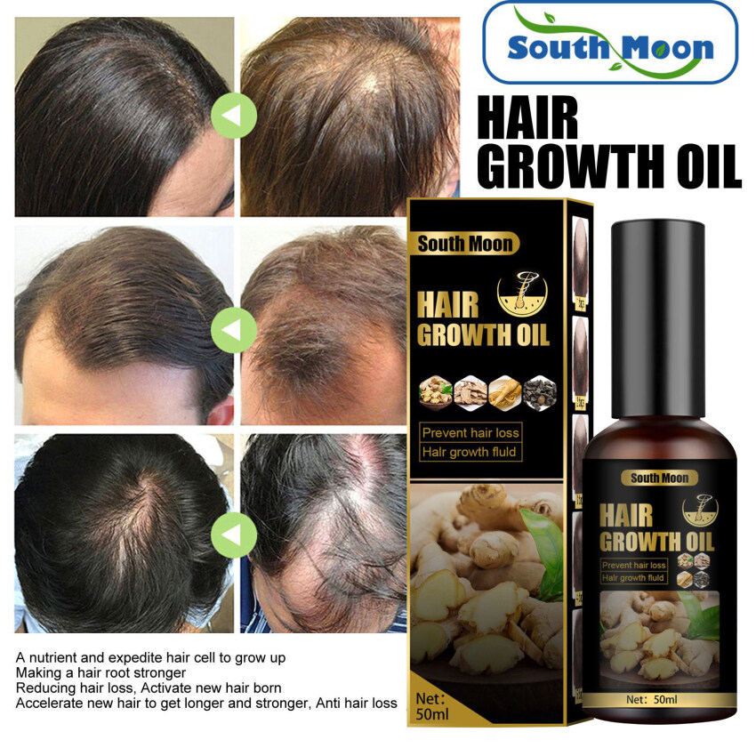 South Moon Hair Growth Products Fast Growing Hair Oil Hair Loss Care Spray Beauty Hair &Amp; Scalp Treatment For Men Women 50ml | Lazada South Moon Hair Growth Products Fast Growing Hair Oil Hair Loss Care Spray Beauty Hair &Amp; Scalp Treatment For Men Women 50ml | Lazada