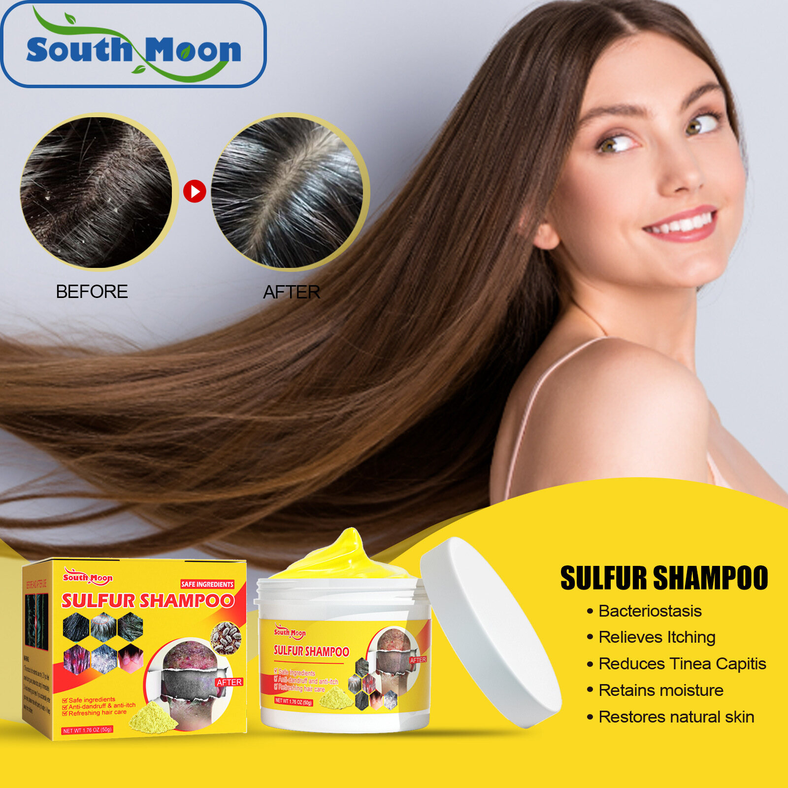 South Moon Shampoo Scalp Removing Lice Relieving Itching Controlling Oil Cleaning Hair Follicles Removing Mites Pimples And Scalp Care Seborrheic Dermatitis Shampoo Natural Hair Care Treatment Itching Mites Scalp Psoriasis Eczema Anti Dandruff Shampoo