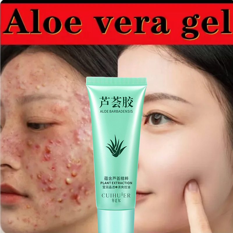 Pore Reduction Removal Oil Control Whitening Aloe Vera Gel Moisturizing Marking Removal After Sun Repair Aloe Vera Gel 40g