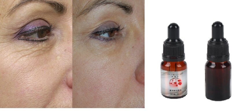 niacinamide dark circles