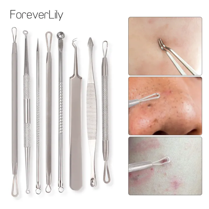 professional blackhead removal