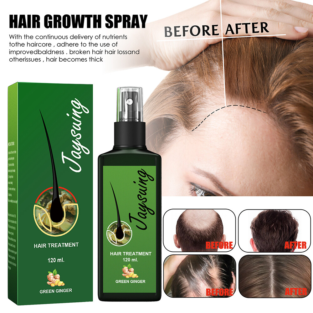 120ml Ginger Hair Growth Essence Spray Product Preventing Baldness Consolidating Hair Anti Hair Loss Serum