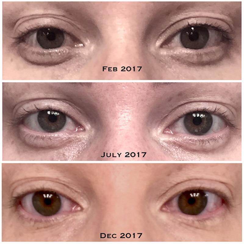 the ordinary eye serum wrinkles