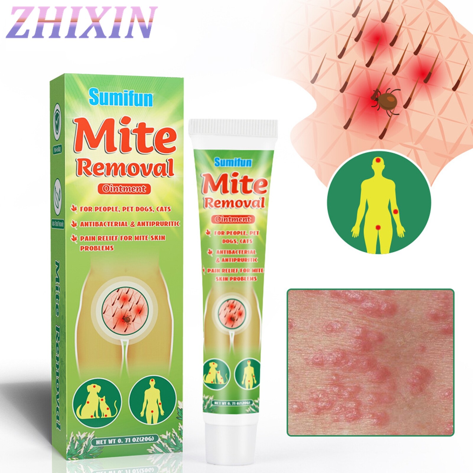 Zhixin 20g Mite Removal Cream Non-Pungent Anti-Itch External Use Scabies Pubic Lice Ointment Skin Eczema Dermatitis Plaster for Adult